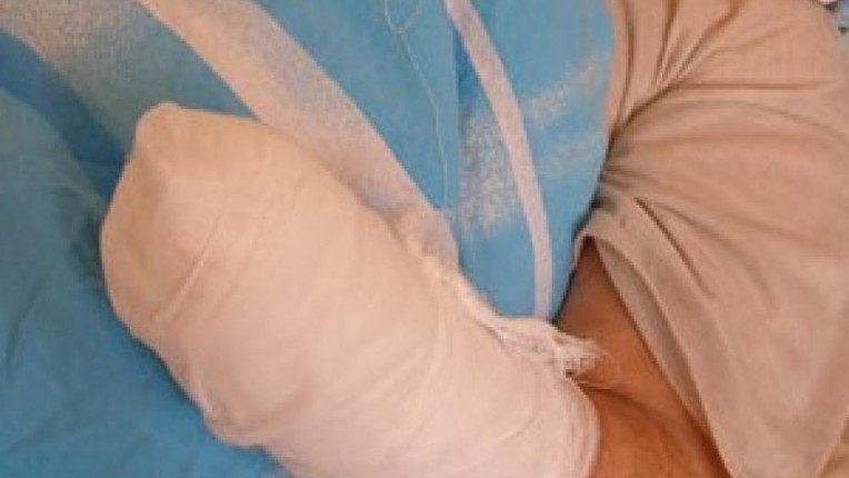 Трагедия в Йошкар-Оле: на заводе женщине оторвало руку
