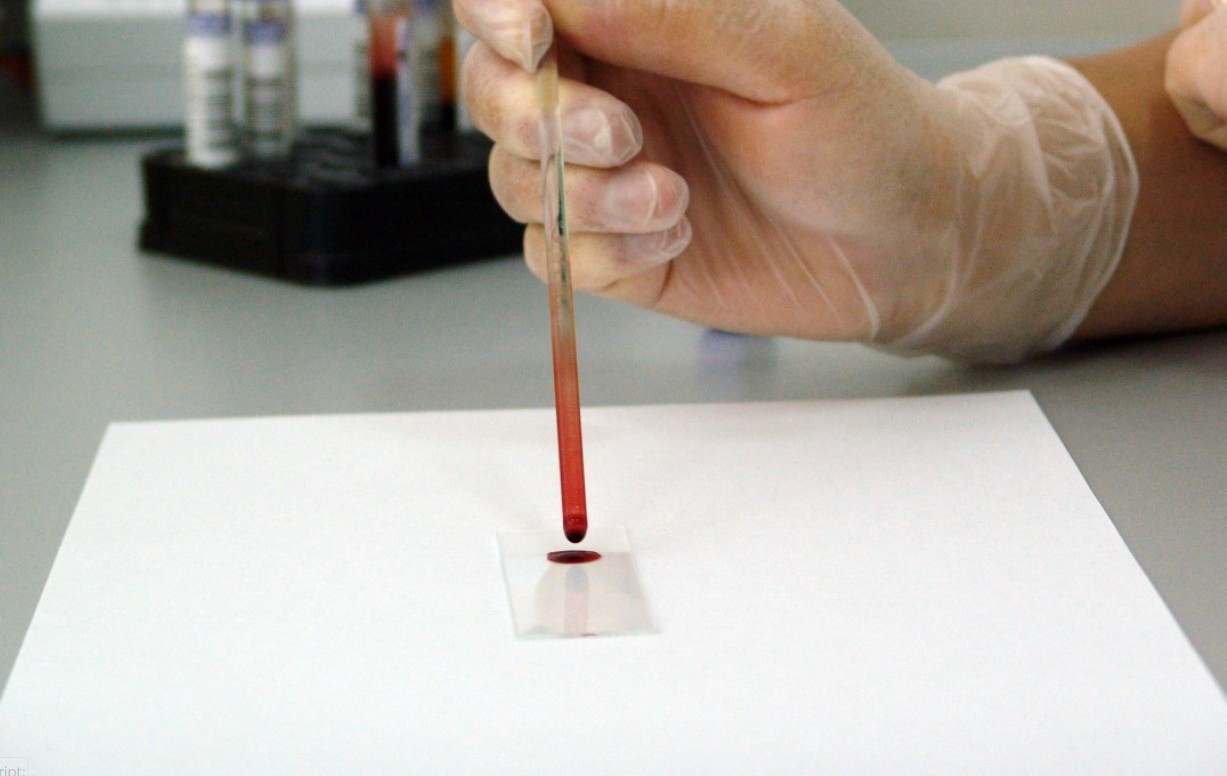 Прошло исследование: нормальный вес не гарантирует защиту от болезни печени