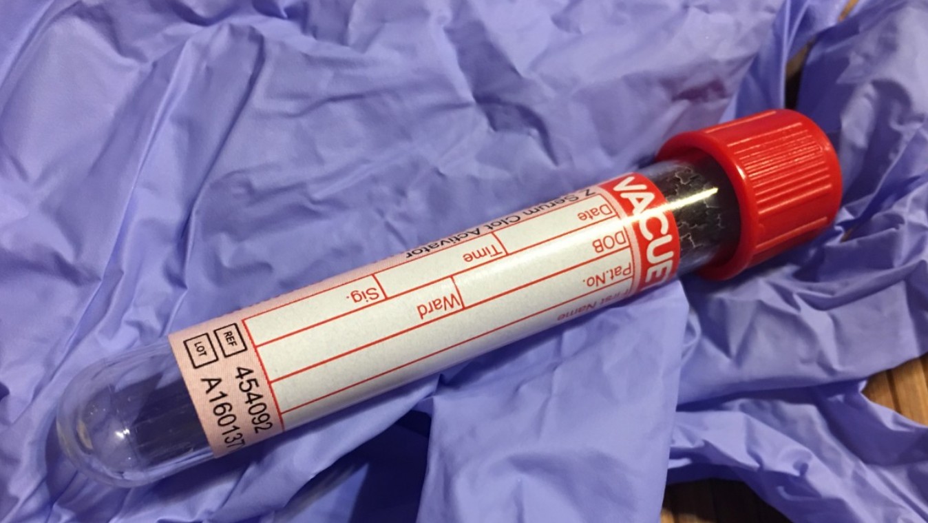 Употребление алкоголя связано с повышенным риском различных видов рака, утверждают ученые